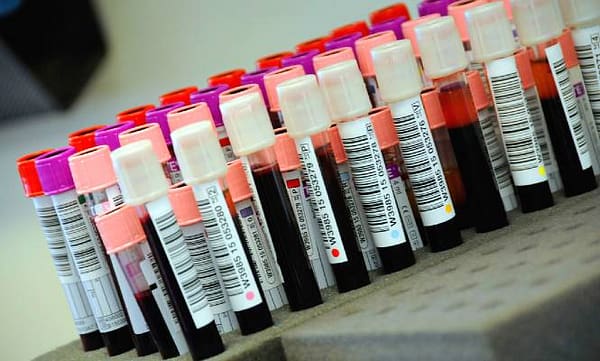 Thumbnail for: Beating a California DUI by Challenging the Blood Test