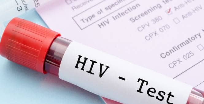 HSC 120291 - Intentionally Exposing Others To HIV Through Sexual Activity