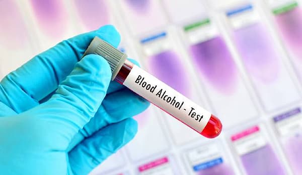 Thumbnail for: Blood Alcohol Testing Methods: Why Modern DUI Tests Can Give Wrong Results