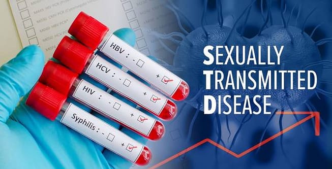 Thumbnail for: Is it a Crime to Transmit an STD in California?
